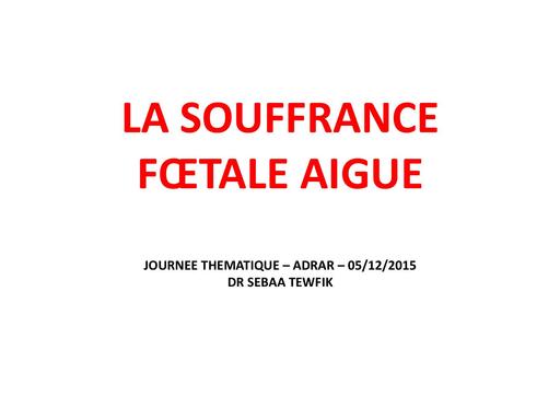 Cours LA SOUFFRANCE FOETALE AIGUE (RC) by TEHUA